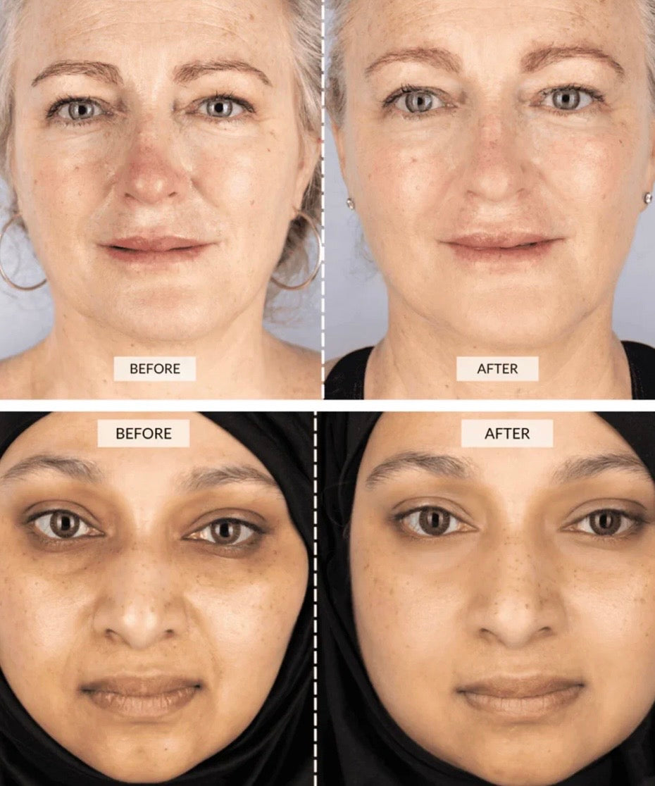 LED LIGHT THERAPY FACE MASK